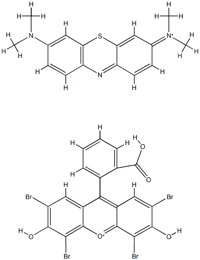 Wright's stain