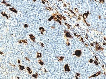 Anti-CD68 antibody [KP1]