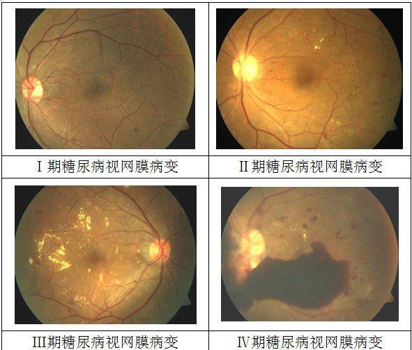 羥苯磺酸鈣產品介紹 