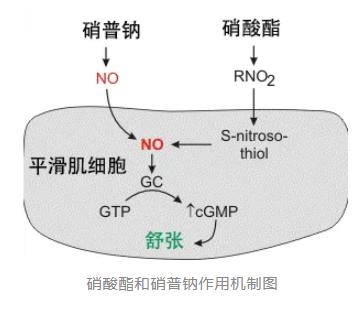 硝酸酯還是硝普鈉，你用對了嗎？