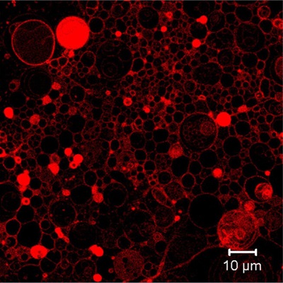 Nile Red Fluorescent image