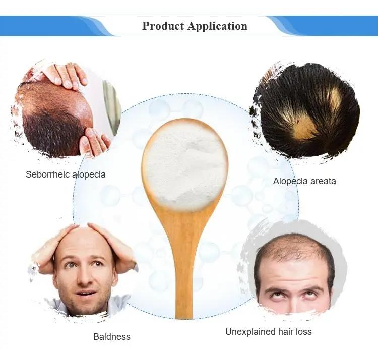 Shop Hair Growth Minoxidil CAS 38304-91-5 Minoxidil raw material EP USP Standard For Anti Hair Loss with good price Ouda-Detailed Image 1