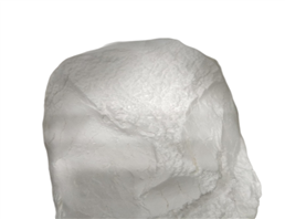 Sulfadiazine