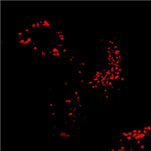 AIE Red Probe for Lysosome