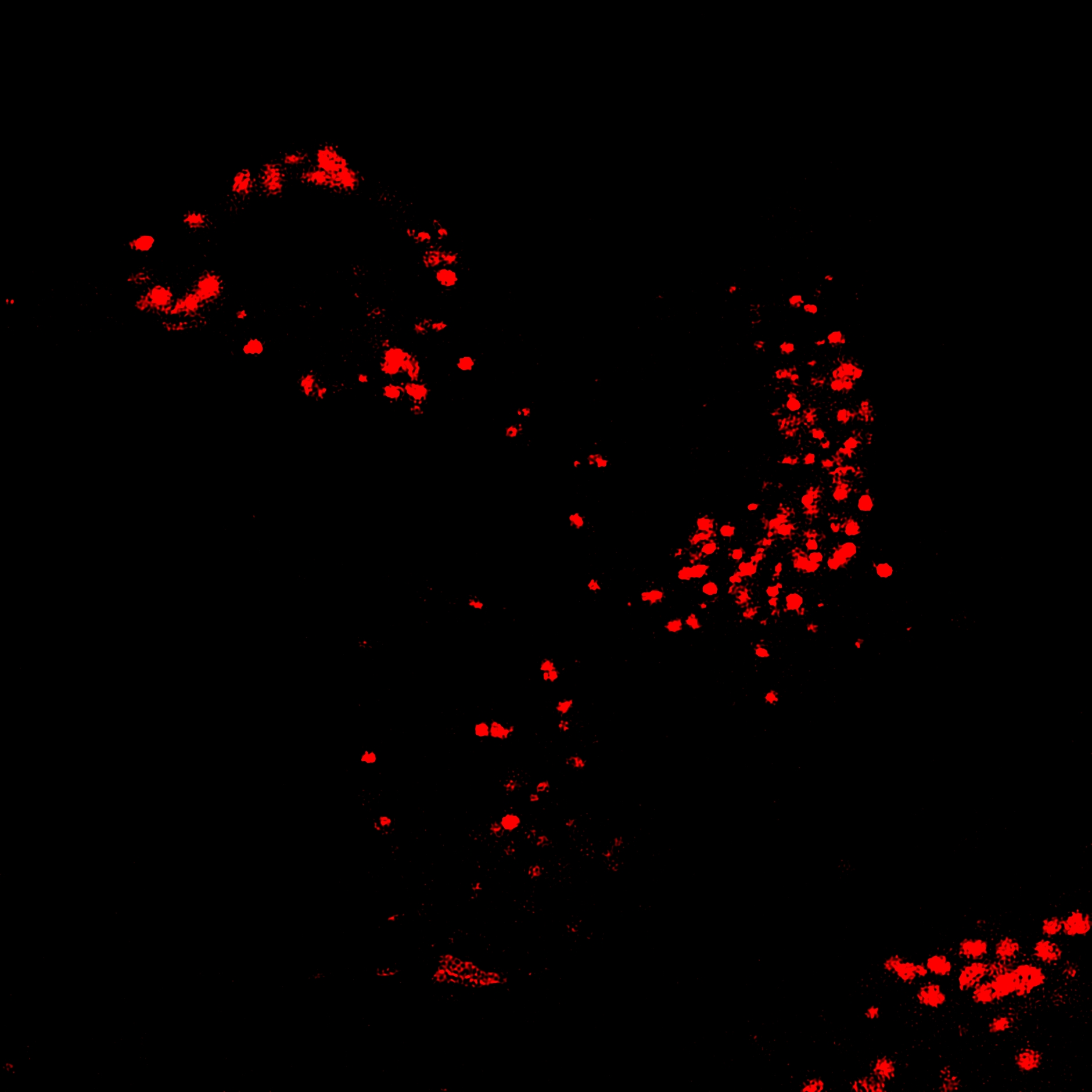 AIE Red Probe for Lysosome