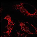 AIE NIR Probe for Mitochondrion