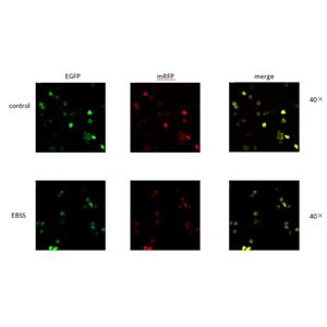 mRFP-EGFP-LC3穩(wěn)轉(zhuǎn)細(xì)胞株