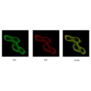 MCF-7 / mRFP-EGFP-LC3穩(wěn)轉(zhuǎn)細(xì)胞株