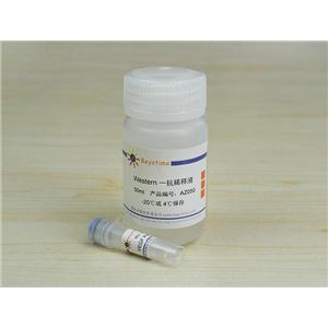 VEGF Rabbit Polyclonal Antibody