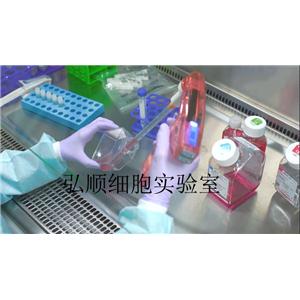 NCI-H660 Cell；人小細(xì)胞癌細(xì)胞