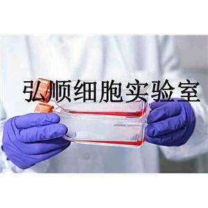 ACC-3人涎腺腺樣囊性癌貼壁細(xì)胞系