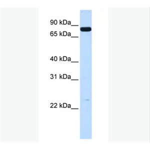 ANTI-HUMAN HGF