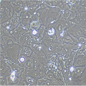 KYSE-150 Fresh Cells|人食管鱗癌細胞(送STR基因圖譜)