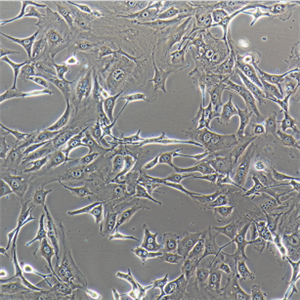 LNCaPcloneFGC人前列腺癌細胞