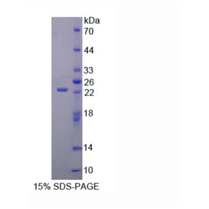 AMPA離子能谷氨酸受體3(GRIA3)重組蛋白