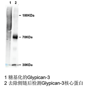 glypican 3小鼠單抗；Anti-Glypican 3 antibody; GPC3 