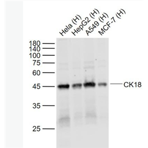 Anti-CK18 antibody-細(xì)胞角蛋白18單克隆抗體