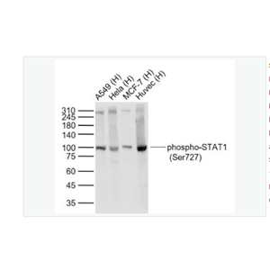 Anti-phospho-STAT1-磷酸化信號(hào)轉(zhuǎn)導(dǎo)與轉(zhuǎn)錄激活因子1重組兔單克隆抗體