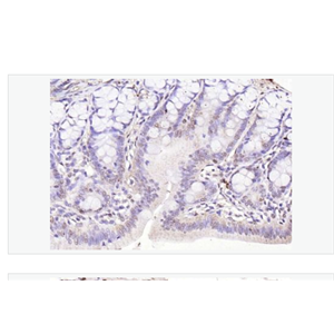 Anti-IL33 antibody-白介素33抗體