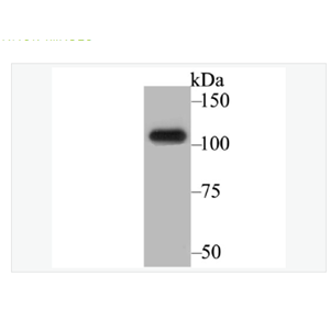 Anti-BRD2 antibody -BRD2蛋白重組兔單克隆抗體