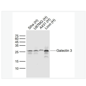 Anti-Galectin 3 antibody-半乳糖凝集素3單克隆抗體