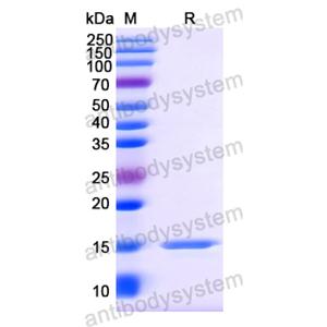 Anti-Vesicular stomatitis Indiana virus/VSIV NP/Nucleoprotein Nanobody (SAA1125)