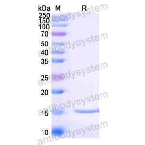 Anti-Human papillomavirus type 16 E7/Protein E7 Nanobody (SAA1326)