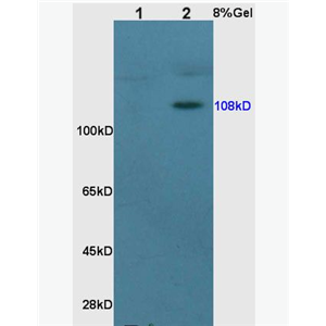 Anti-NR3C2/Mineralocorticoid receptor antibody -鹽皮質(zhì)激素受體抗體