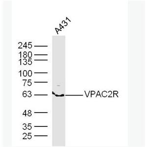 Anti-VPAC2R antibody-腺苷酸環(huán)化酶激活肽受體-II/血管活性腸肽受體-II抗體