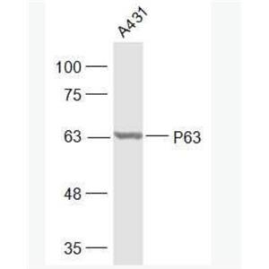 Anti-P63 antibody-腫瘤抑制基因p63α抗體