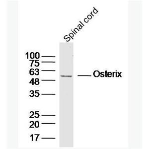 Anti-SP7/Osterix  antibody-成骨相關(guān)轉(zhuǎn)錄因子抗體