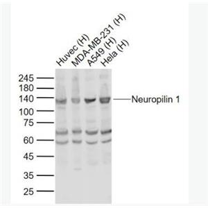 Anti-Neuropilin 1 antibody-神經(jīng)纖毛蛋白1抗體