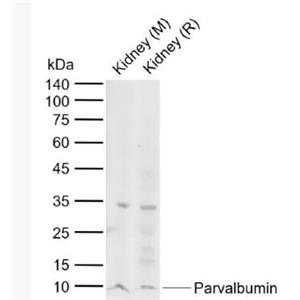 Anti-Parvalbumin antibody-細(xì)小清蛋白抗體