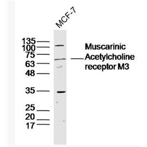 Anti-Muscarinic Acetylcholine receptor M3 antibody-毒蕈堿型乙酰膽堿受體M3抗體