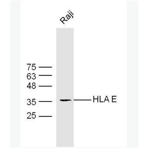 Anti-HLA E antibody-人類(lèi)白細(xì)胞抗原E抗體