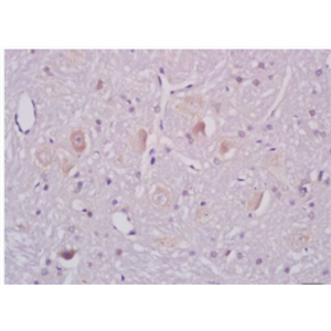 Anti-ganglioside GM1  antibody-神經(jīng)節(jié)苷酯抗體