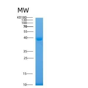 Recombinant Human TAU Protein