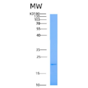 Recombinant Human A2LD1 Protein