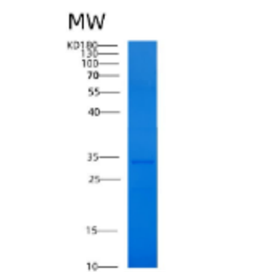 Recombinant Human 14-3-3 η/ YWHA1 Protein