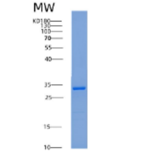 Recombinant Human 14-3-3 ζ/YWHAZ Protein