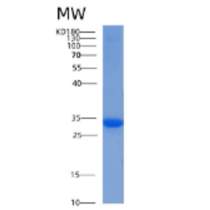 Recombinant Human 14-3-3 ε/YWHAE Protein