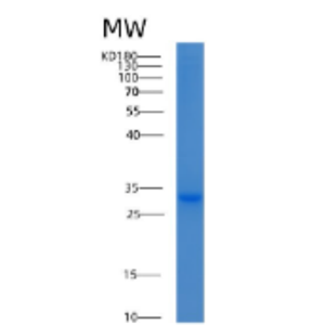 Recombinant Human 14-3-3 eta/YWHAH Protein