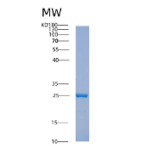 Recombinant Human ABHD14B Protein