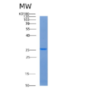 Recombinant Human AASDHPPT Protein