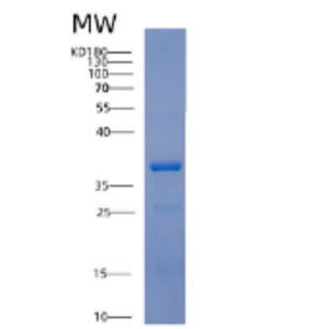 Recombinant Human AAGAB Protein