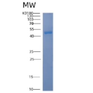 Recombinant Human ACAD8 Protein