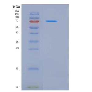 Recombinant Mouse E-Cadherin / CDH1 / E-cad / CD324 Protein (His tag)