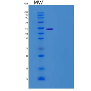 Recombinant Human Noggin / NOG Protein (Fc tag)