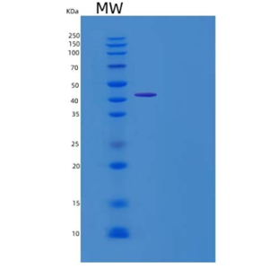 Recombinant Rat Cripto / TDGF1 Protein (Fc tag)