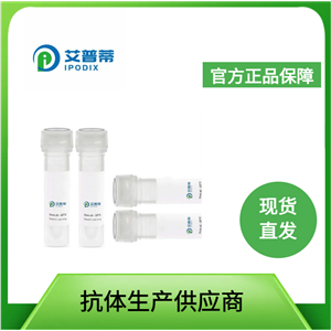 DGKD抗體；DGKD antibody 艾普蒂生物      